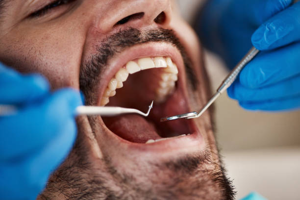 Best Dental Fillings (Composite and Amalgam)  in Helena, OK